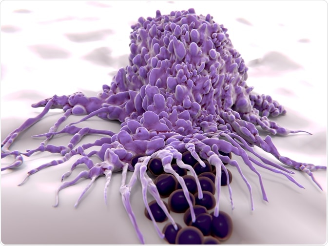 Role Of Macrophages In Cancer