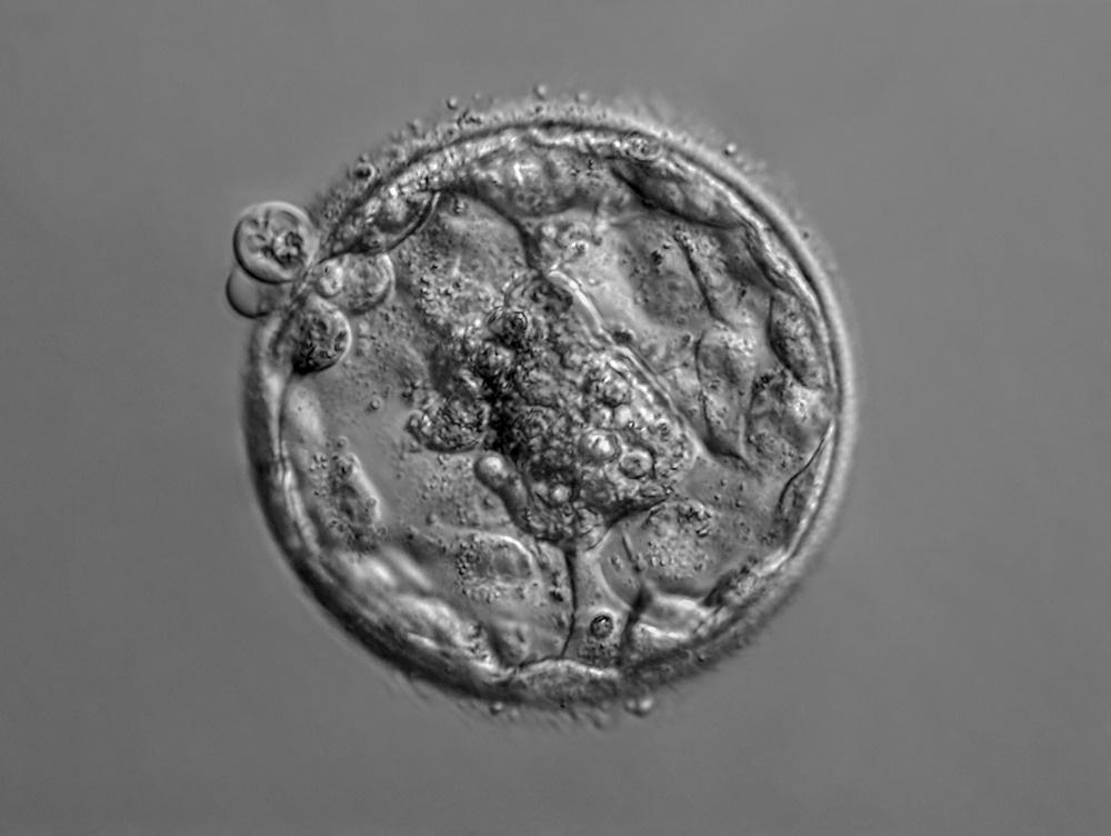 Human Embryo