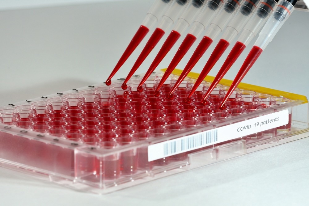 High Throughput Screening of COVID samples