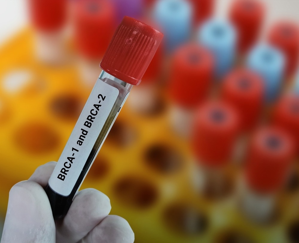 BRCA1 and BRCA2 Test