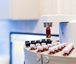 Current Challenges in Mass Spectrometry Instruments