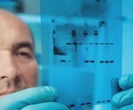 What is Western Blotting?