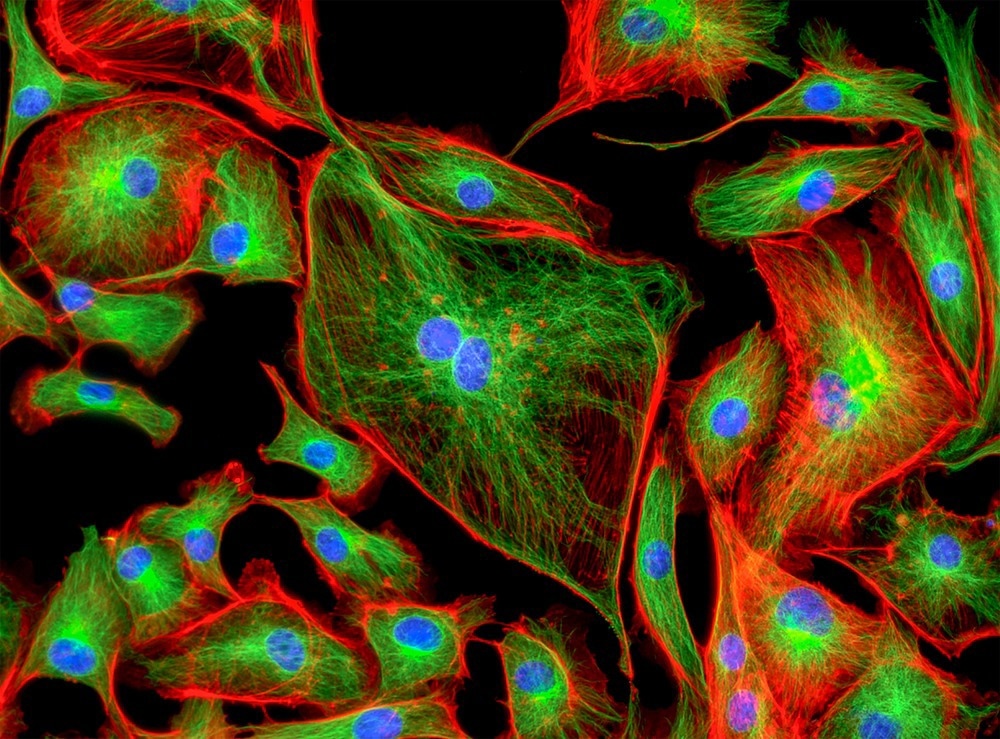 endothelial cells