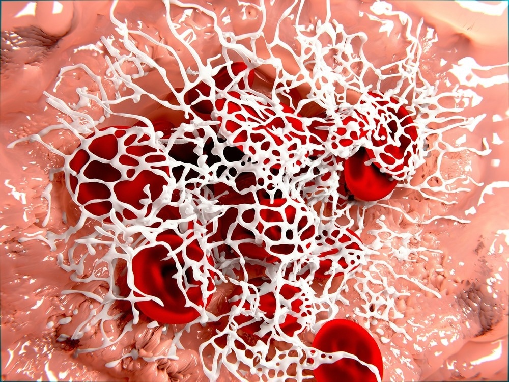 Fibrin Clot