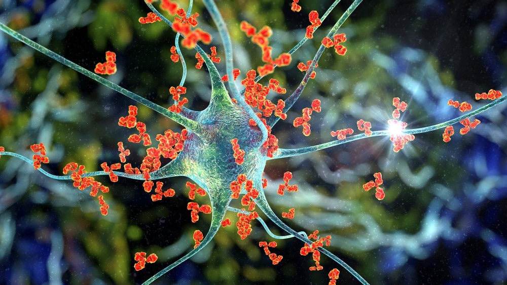 Autoimmune Disease