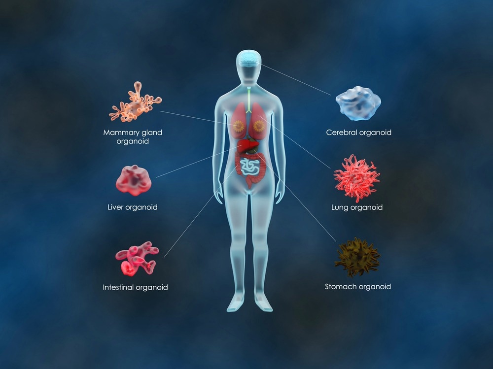 Organoid