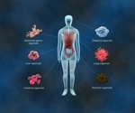 How could Organoids Transform the Future of Personalised Medicine?