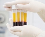 What is Separation Science?