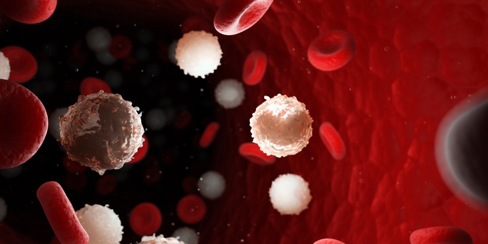 Diagnosing Leukemia Using Flow Cytometry