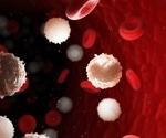 Diagnosing Leukemia Using Flow Cytometry