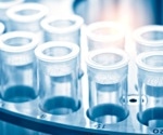 Mass Spectrometry Imaging in the Analysis of Biological Samples