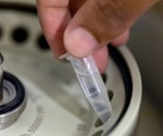 Unlocking Speed and Precision: Magnetic Beads in Protein Isolation