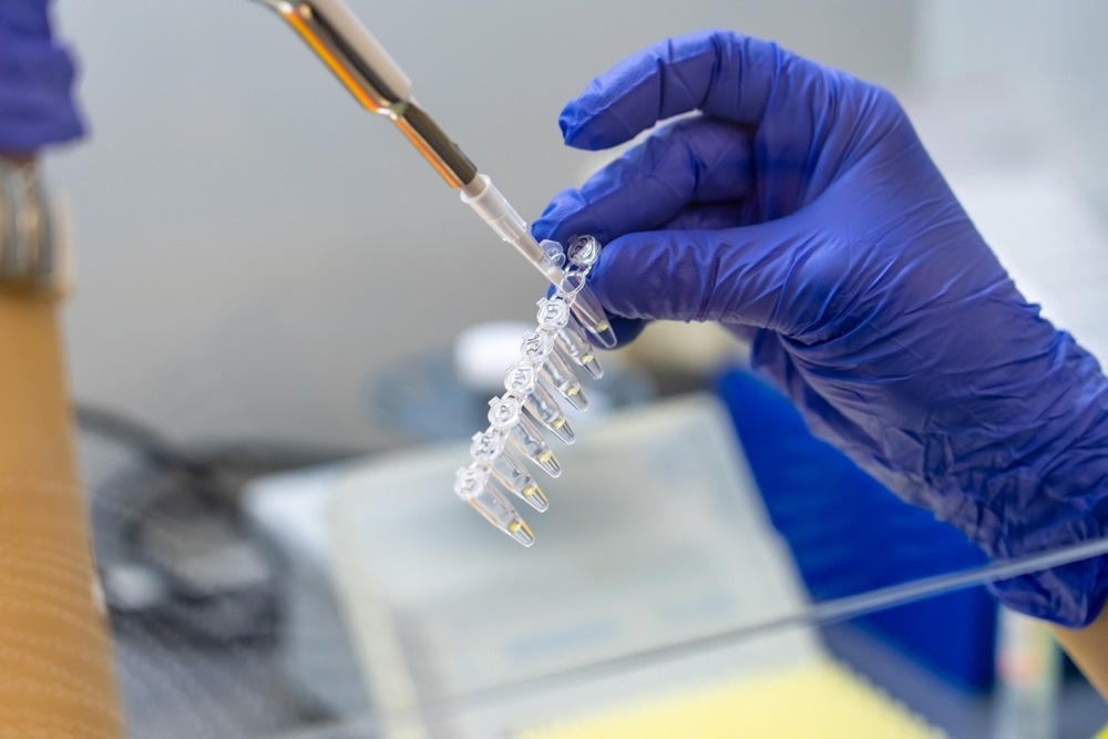 Scientist pipetting sample into vial for DNA testing. Scientist loads samples DNA monkeypox amplification by PCR into plastic strip tubes.