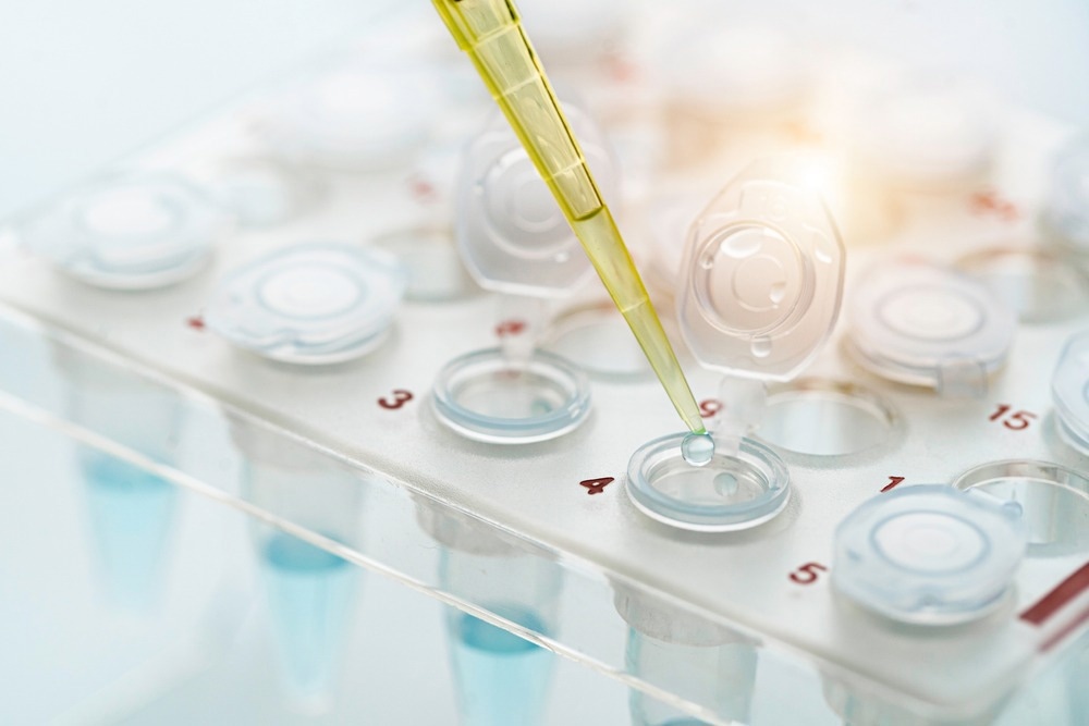Close up shot of dropping sample from yellow tip to eppendorf tube in rack. Molecular research analysis concept.