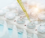 Luminex-Based Immunoassay Systems for Biomedical Labs