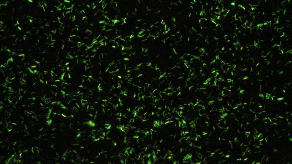 tb fluorescence microscopy