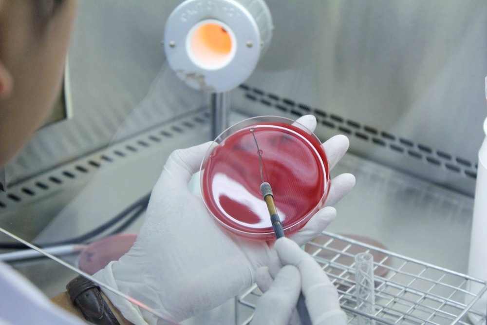 Sputum culture process, Blurry and selective focus
