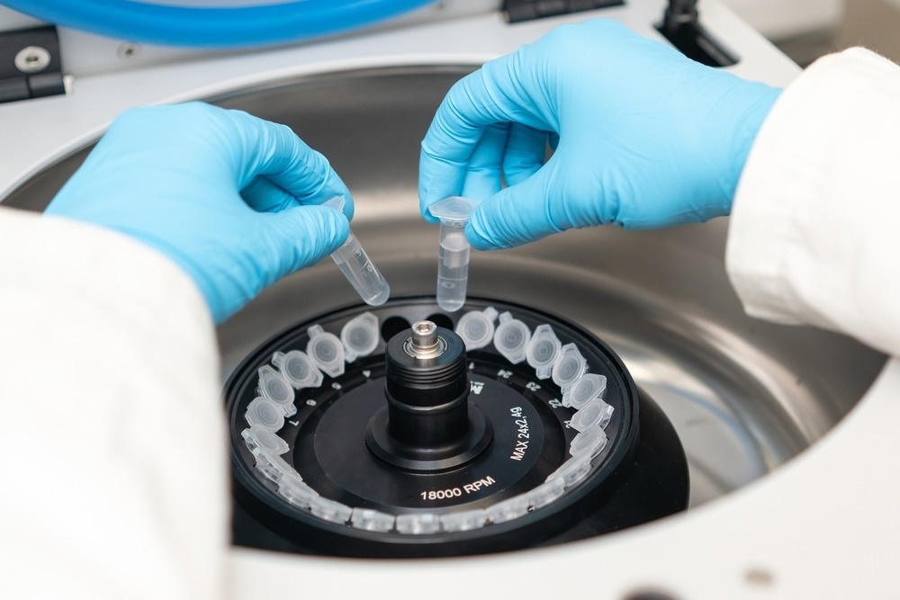 Laboratory worker puts chemical tubes into the centrifuge. Biochemistry and research laboratory concept. DNA and pharmaceutical analysis.