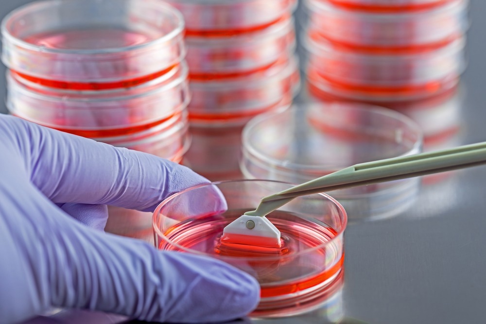 Harvesting cells with a cell scraper