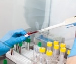 Fluorescence In Situ Hybridization (FISH) Techniques and Methods