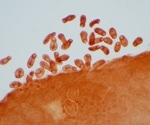 Current Approaches in Vaccine Development for Parasitic Diseases