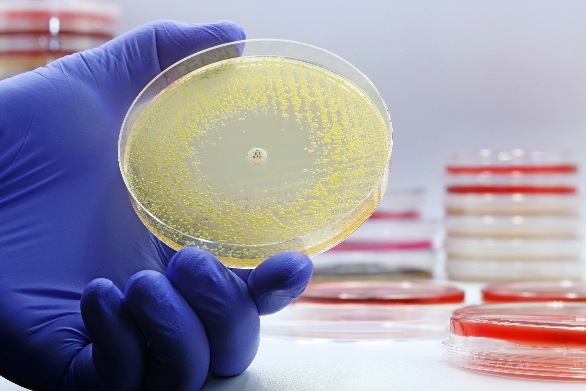 The rise of antibiotic-resistant bacterial infections.