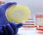 Mechanisms of Antibiotic Resistance: A Molecular Perspective