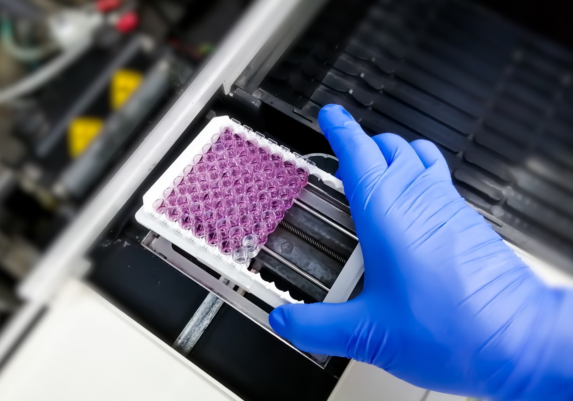 Enzyme-linked immunosorbent assay (ELISA) plate. Scientist taking Optical Density (OD) of patient