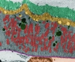 What Is Spatial Transcriptomics?