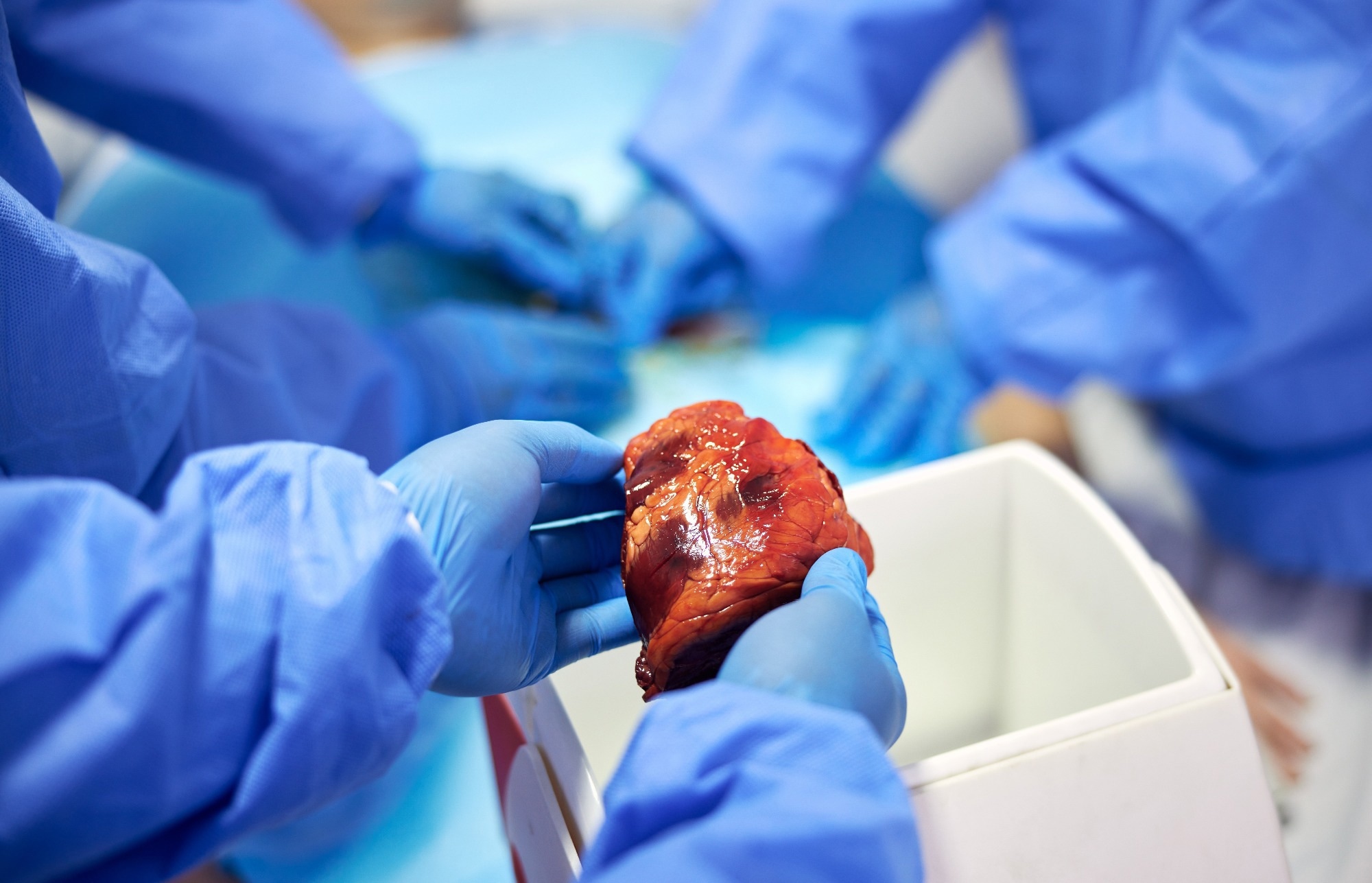 Surgeon hands holding heart to be transplanted into patient