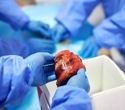 How Xenotransplantation Moved From Failed Experiments To Lifesaving Reality