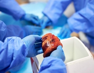 How Xenotransplantation Moved From Failed Experiments To Lifesaving Reality