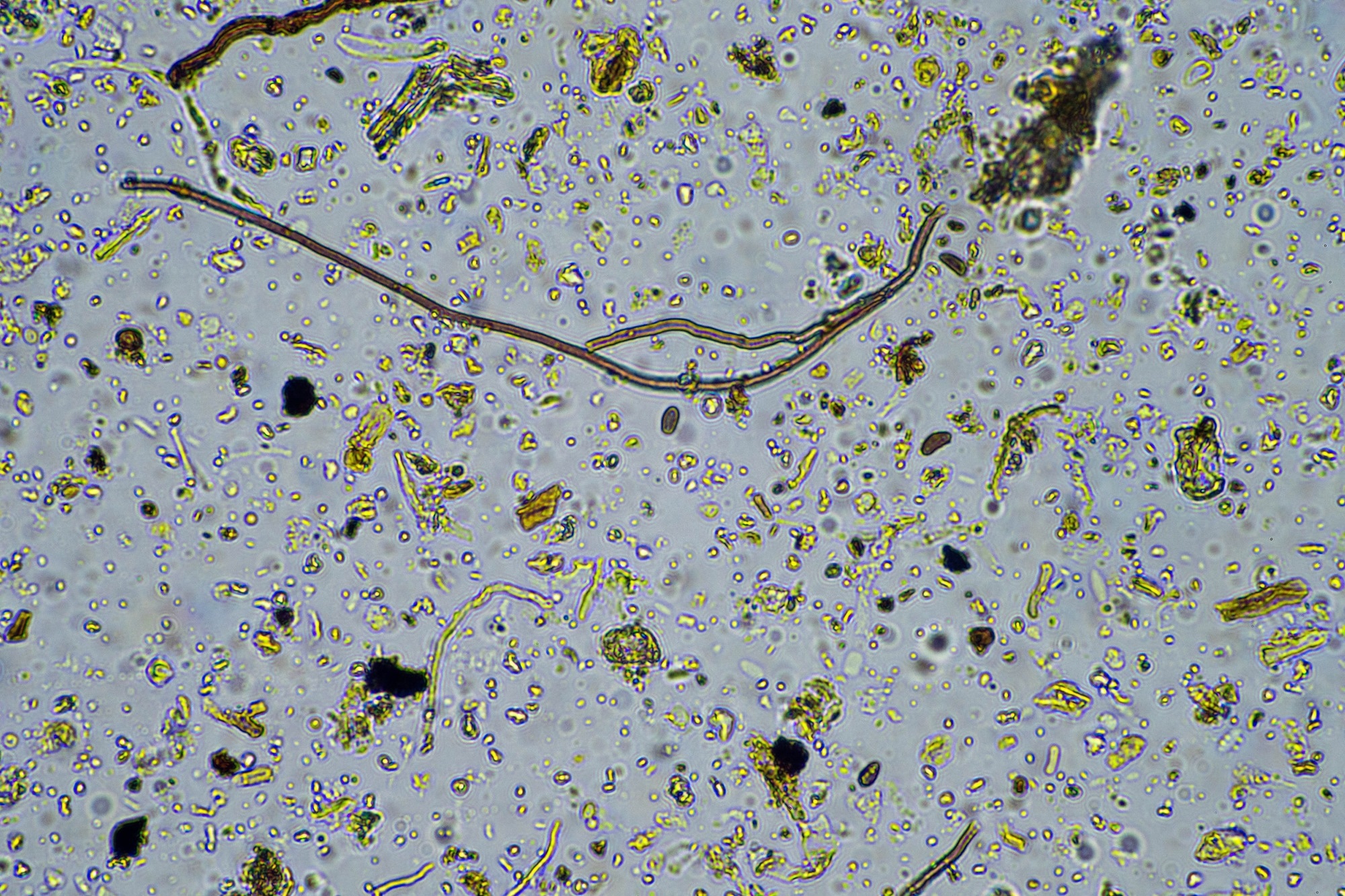 soil microorganisms close up under the microscope. Soil sample from a farm