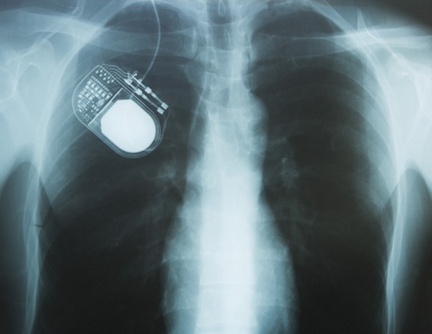 Smart Implants and Closed-Loop Systems: The Next Generation of Therapeutic Devices