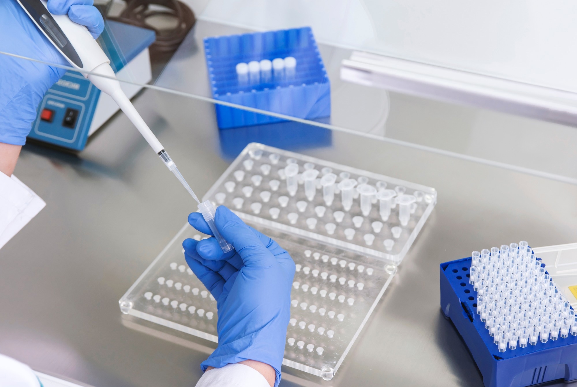 hands of a lab technician with a plastic tubes, plastic gloves, plastic trays and plastic pipette top box