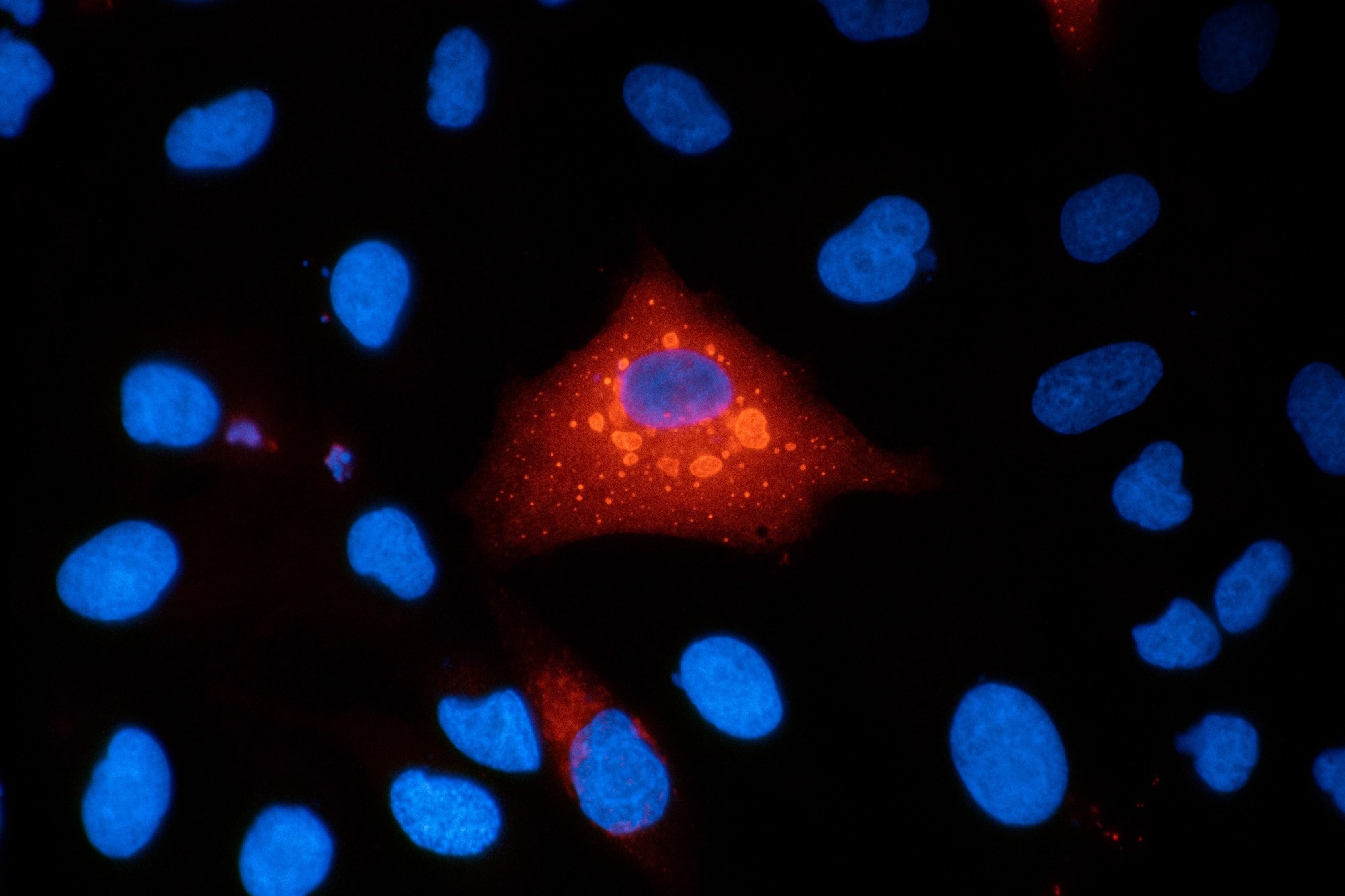 Immunofluorescence micrograph of A549 human lung carcinoma cells stained for p62 (SQSTM1) and DAPI, showing intracellular protein localization and cell nuclei