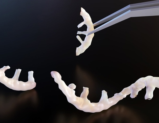 RNA Editing and Epitranscriptomics: Emerging Tools for Precision Medicine