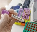 Multi-Cancer Early Detection: How Blood Tests Are Transforming Cancer Screening