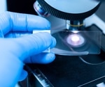 How AI Predicts Molecular Biomarkers From H&E Slides