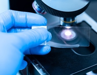 How AI Predicts Molecular Biomarkers From H&E Slides