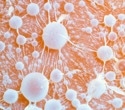 What Is Transmissible Cancer and How Does It Spread?