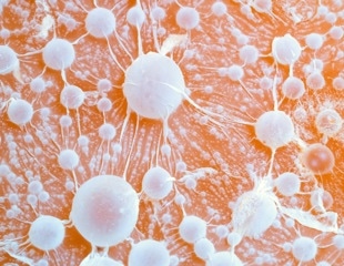 What Is Transmissible Cancer and How Does It Spread?