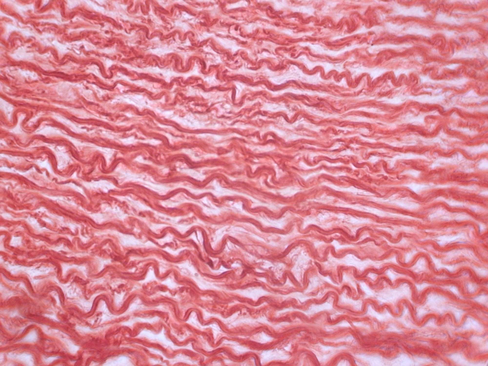 Microscopic image showing densely packed, wavy pink-stained connective tissue fibers arranged in approximately parallel layers.