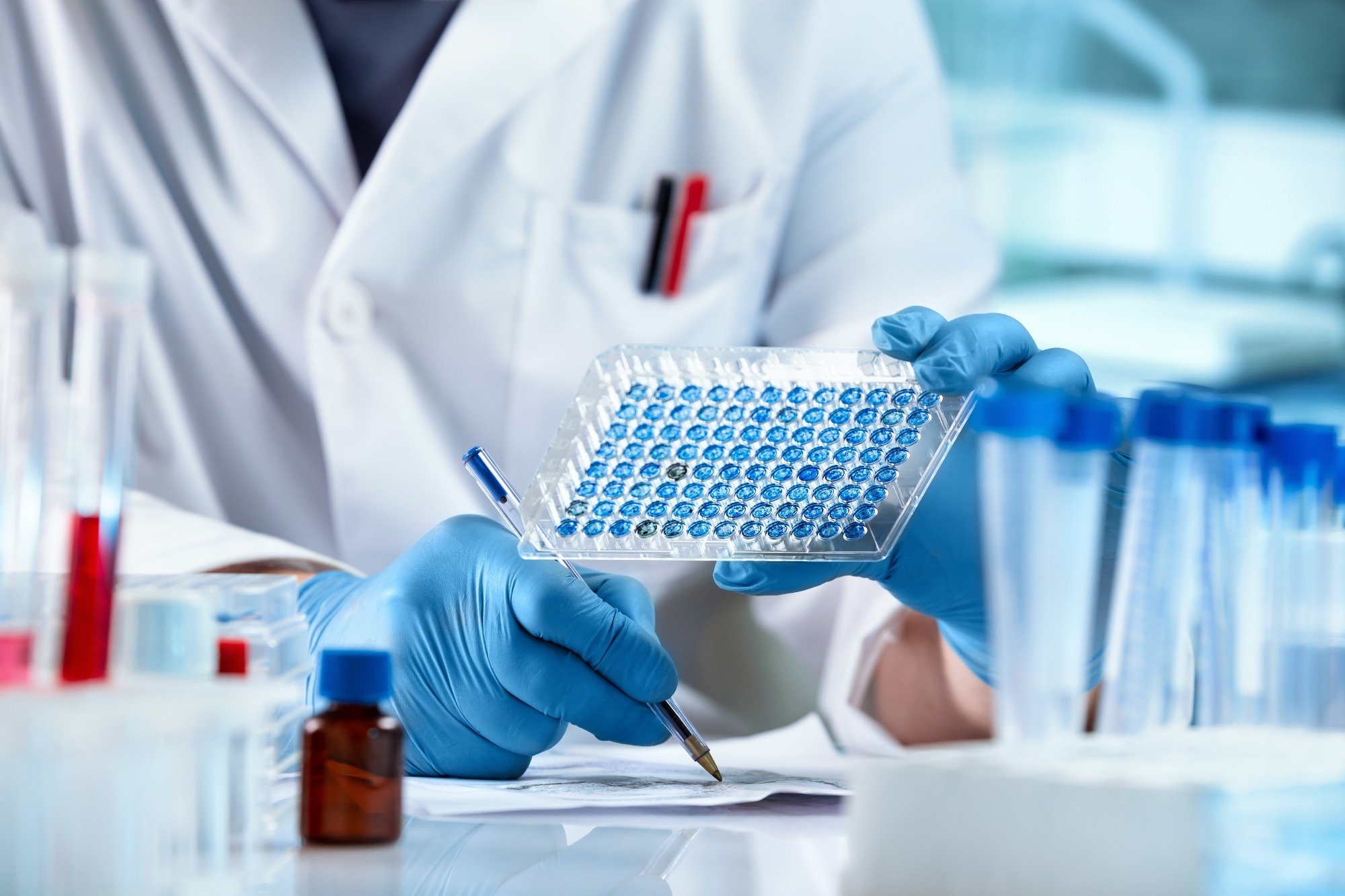 Researcher Sample Analysis and writes down the data result of for elisa analysis.