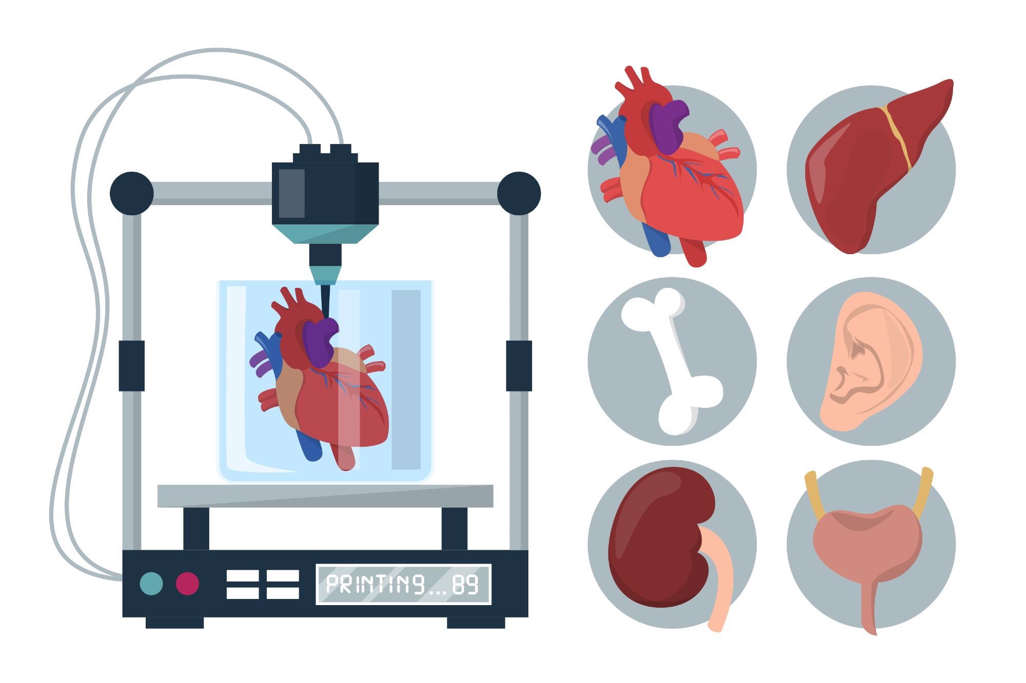 Bioprinting