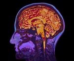 Using Microscopy for Deep In Vivo Brain Imaging