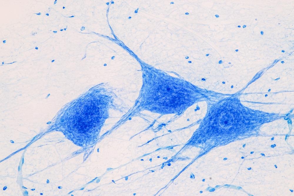 Motor Neuron Under Microscope