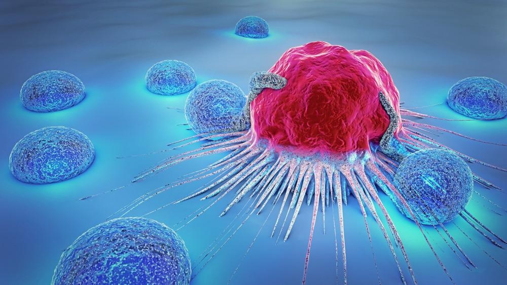 Tumor