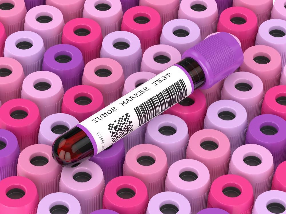 Biomarker Test