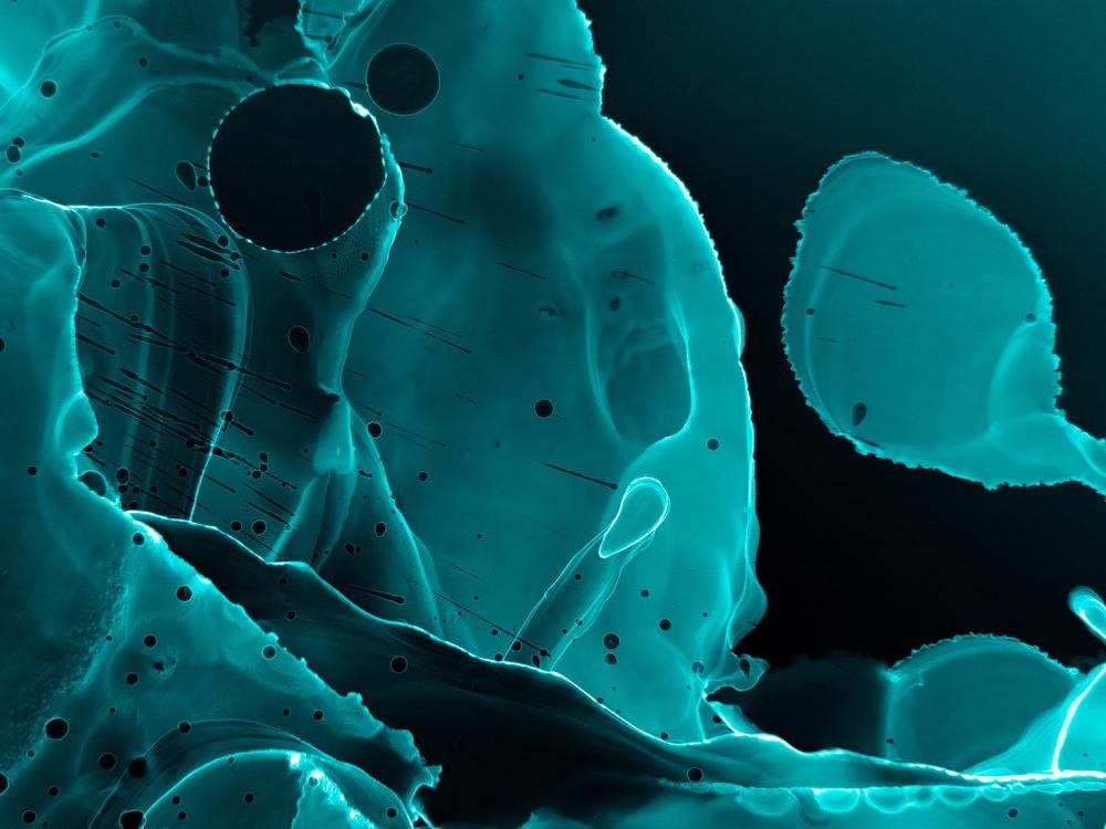 X-Ray Microscopy